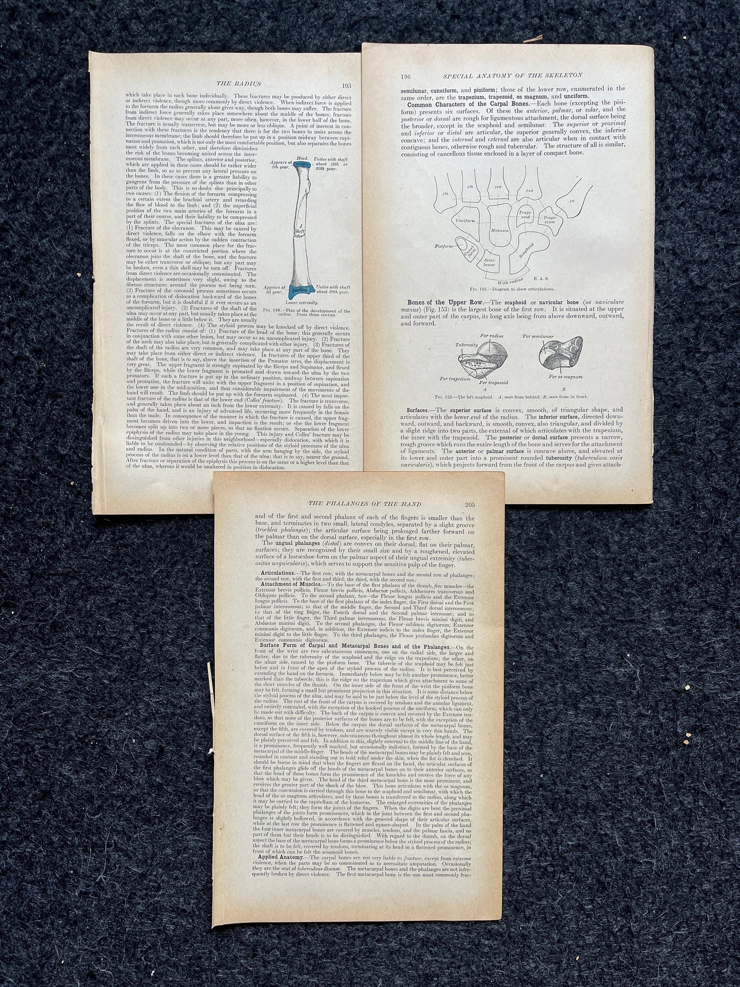 Original 1913 Anatomy Pages of Human Body, Anatomy Physiology Textbook Gifts, Teachers Aid Biology, Heart Brain Lung Art Wall Decoration