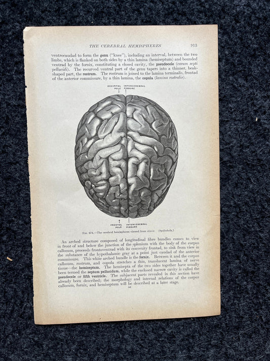 Original 1913 Anatomy Pages of Human Body, Anatomy Physiology Textbook Gifts, Teachers Aid Biology, Heart Brain Lung Art Wall Decoration