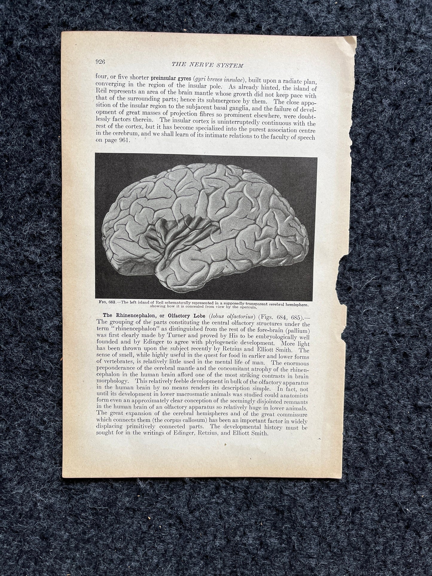 Original 1913 Anatomy Pages of Human Body, Anatomy Physiology Textbook Gifts, Teachers Aid Biology, Heart Brain Lung Art Wall Decoration