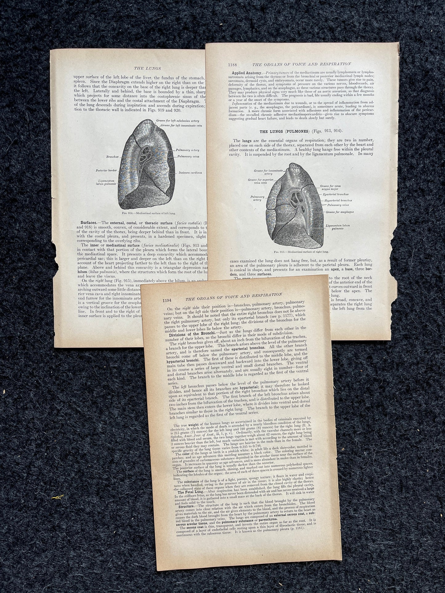Original 1913 Anatomy Pages of Human Body, Anatomy Physiology Textbook Gifts, Teachers Aid Biology, Heart Brain Lung Art Wall Decoration