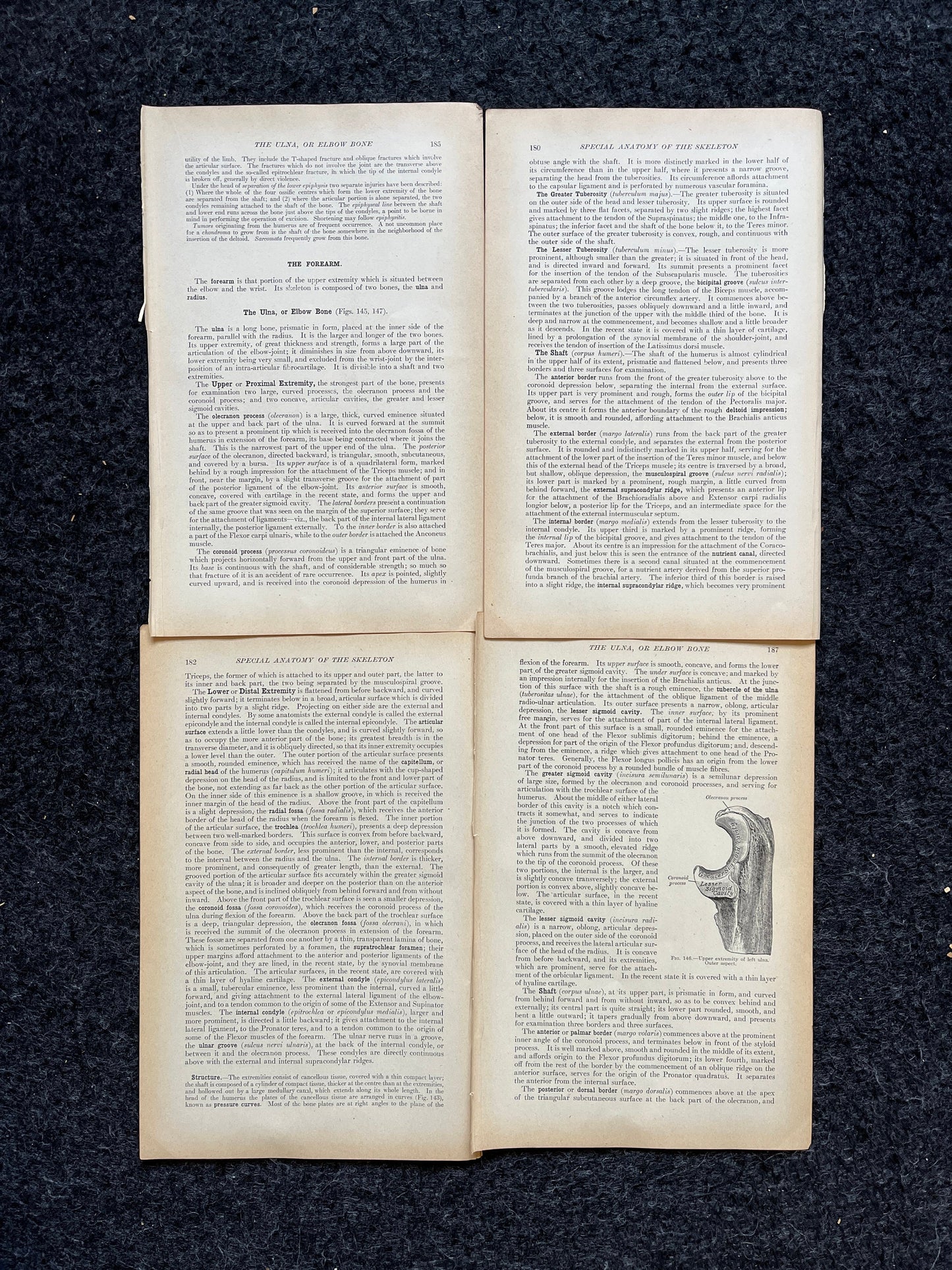 Original 1913 Anatomy Pages of Human Body, Anatomy Physiology Textbook Gifts, Teachers Aid Biology, Heart Brain Lung Art Wall Decoration
