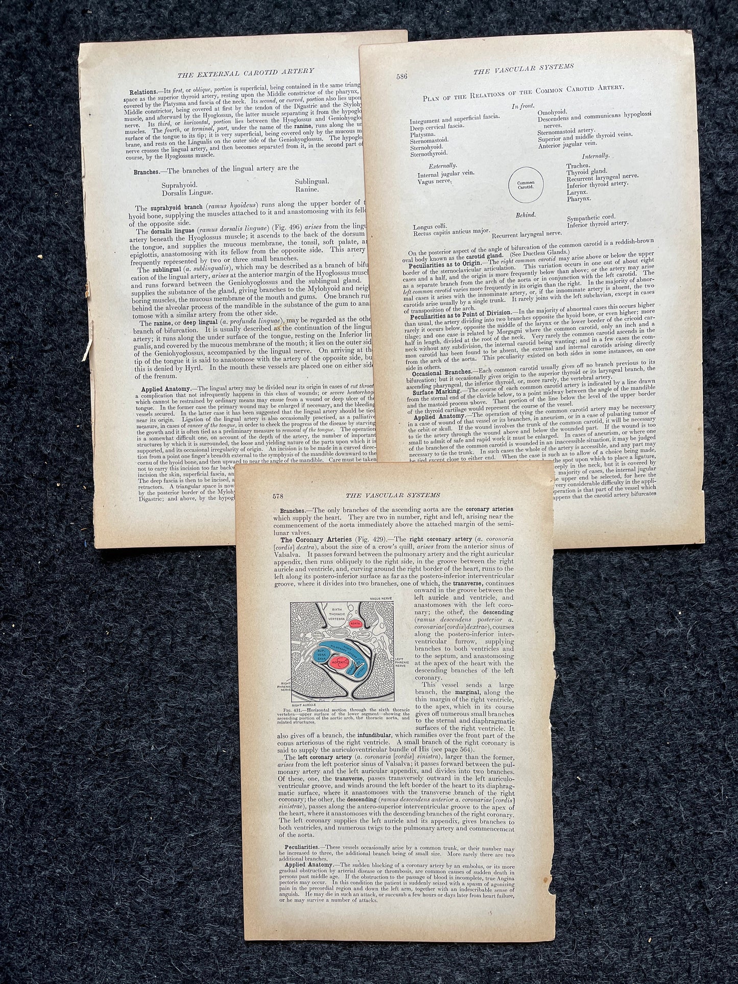 Original 1913 Anatomy Pages of Human Body, Anatomy Physiology Textbook Gifts, Teachers Aid Biology, Heart Brain Lung Art Wall Decoration
