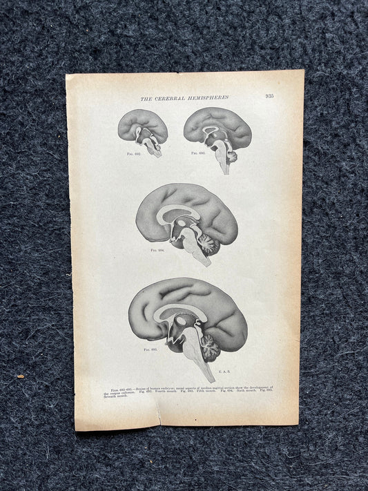 Original 1913 Anatomy Pages of Human Body, Anatomy Physiology Textbook Gifts, Teachers Aid Biology, Heart Brain Lung Art Wall Decoration