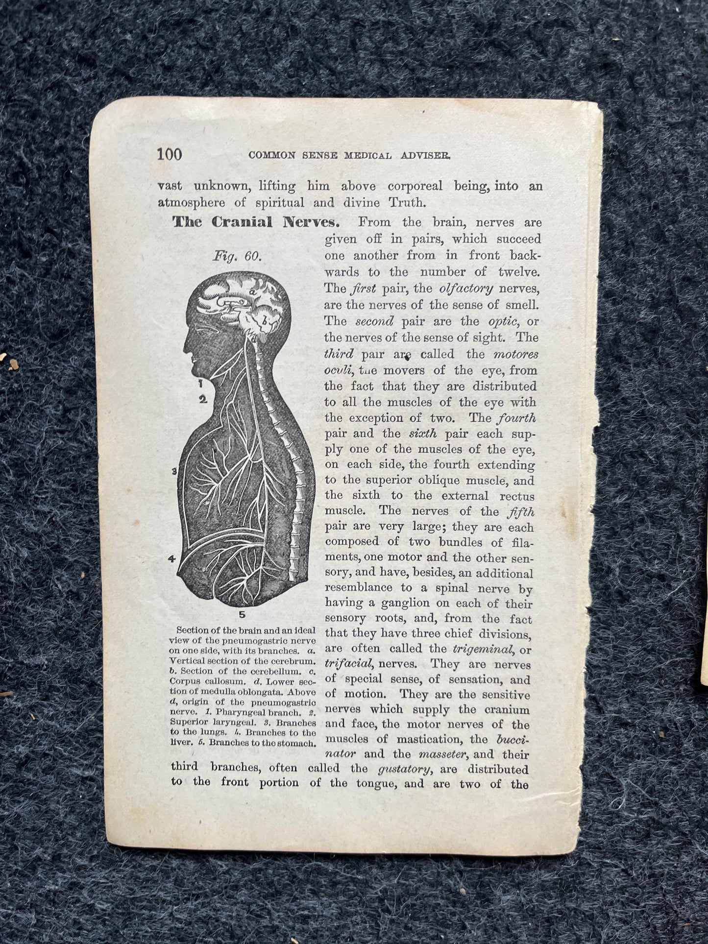 Original 1848 Anatomy Pages of Medical Art, Anatomy Physiology Gifts, Teachers Aid Biology, Morbid Gifts, Witch Decor Gifts, Human Body