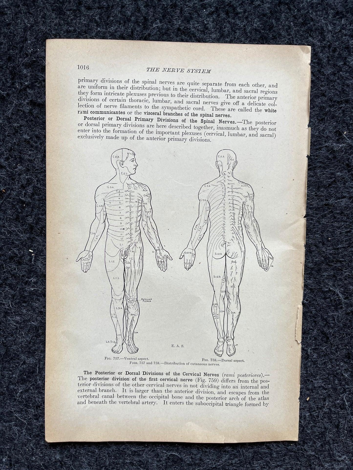 Original 1913 Anatomy Pages of Human Body, Anatomy Physiology Textbook Gifts, Teachers Aid Biology, Heart Brain Lung Art Wall Decoration