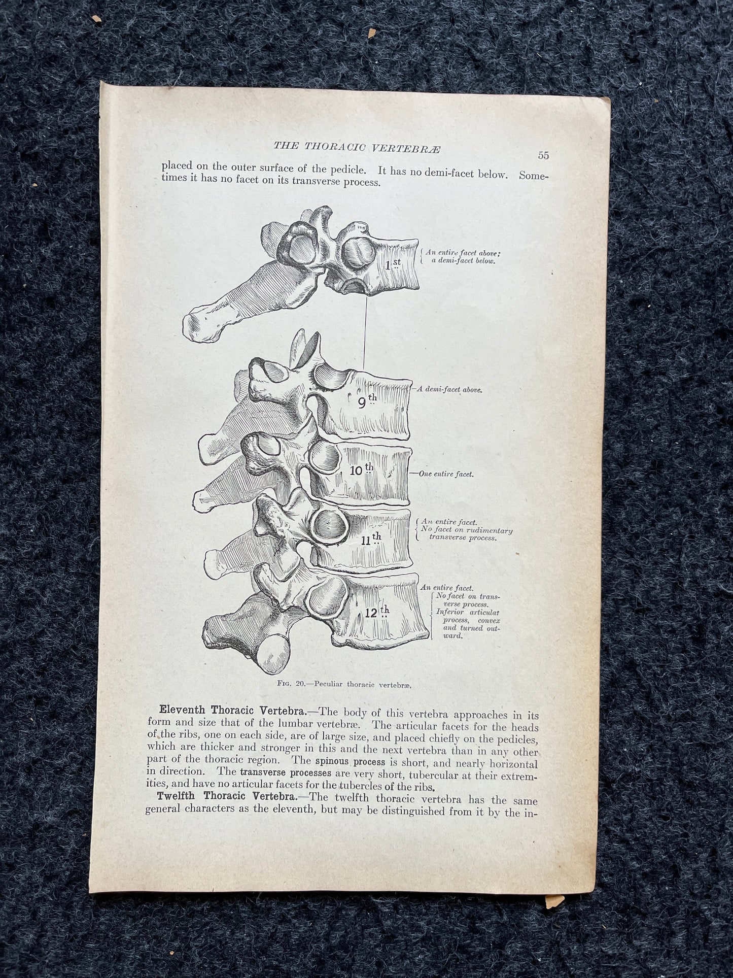 Original 1913 Anatomy Pages of Human Body, Anatomy Physiology Textbook Gifts, Teachers Aid Biology, Heart Brain Lung Art Wall Decoration