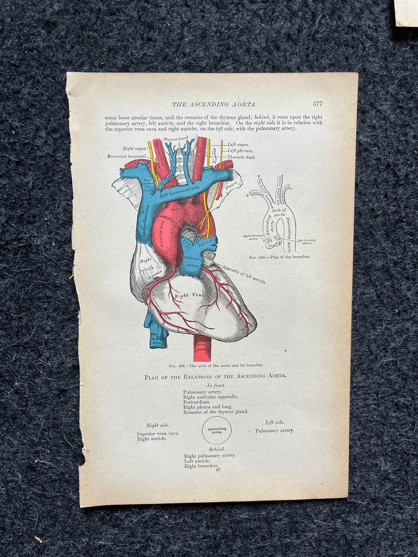 Original 1913 Anatomy Pages of Human Body, Anatomy Physiology Textbook Gifts, Teachers Aid Biology, Heart Brain Lung Art Wall Decoration