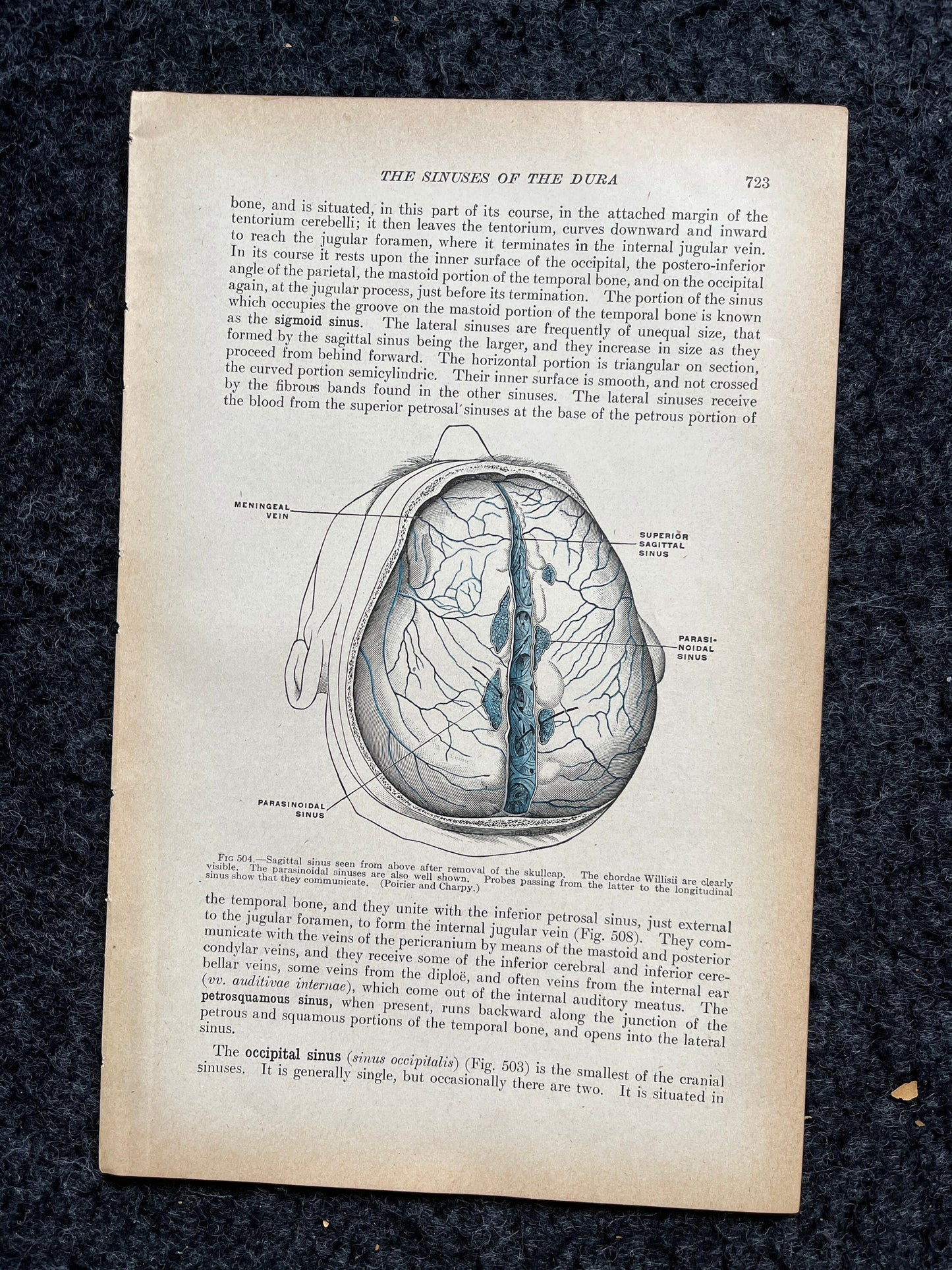 Original 1913 Anatomy Pages of Human Body, Anatomy Physiology Textbook Gifts, Teachers Aid Biology, Heart Brain Lung Art Wall Decoration