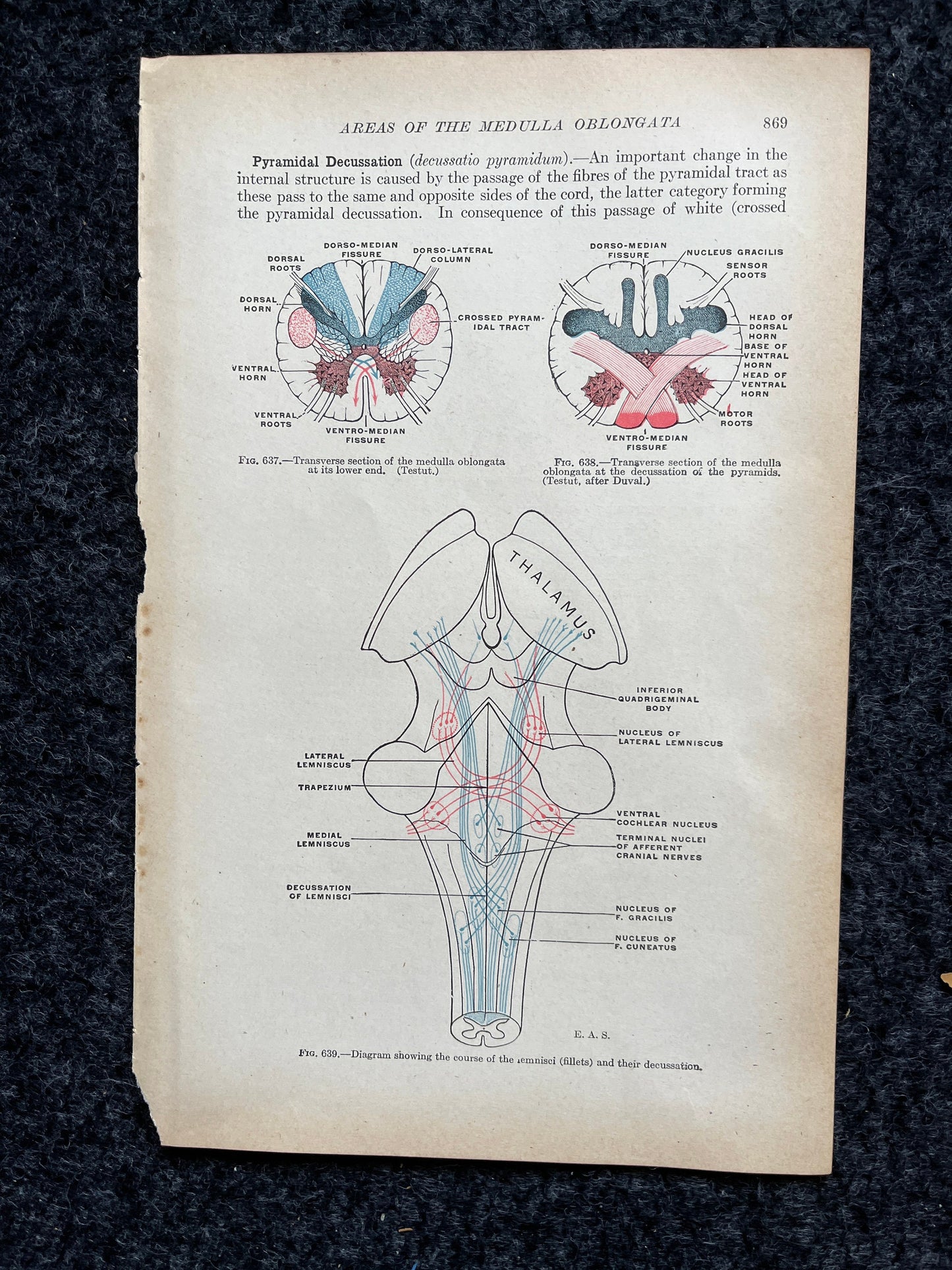 Original 1913 Anatomy Pages of Human Body, Anatomy Physiology Textbook Gifts, Teachers Aid Biology, Heart Brain Lung Art Wall Decoration
