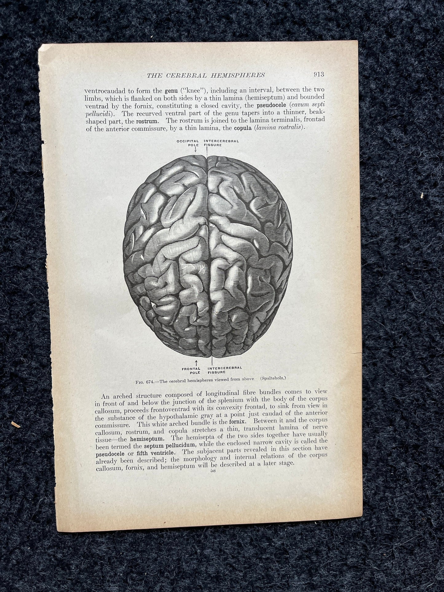 Original 1913 Anatomy Pages of Human Body, Anatomy Physiology Textbook Gifts, Teachers Aid Biology, Heart Brain Lung Art Wall Decoration