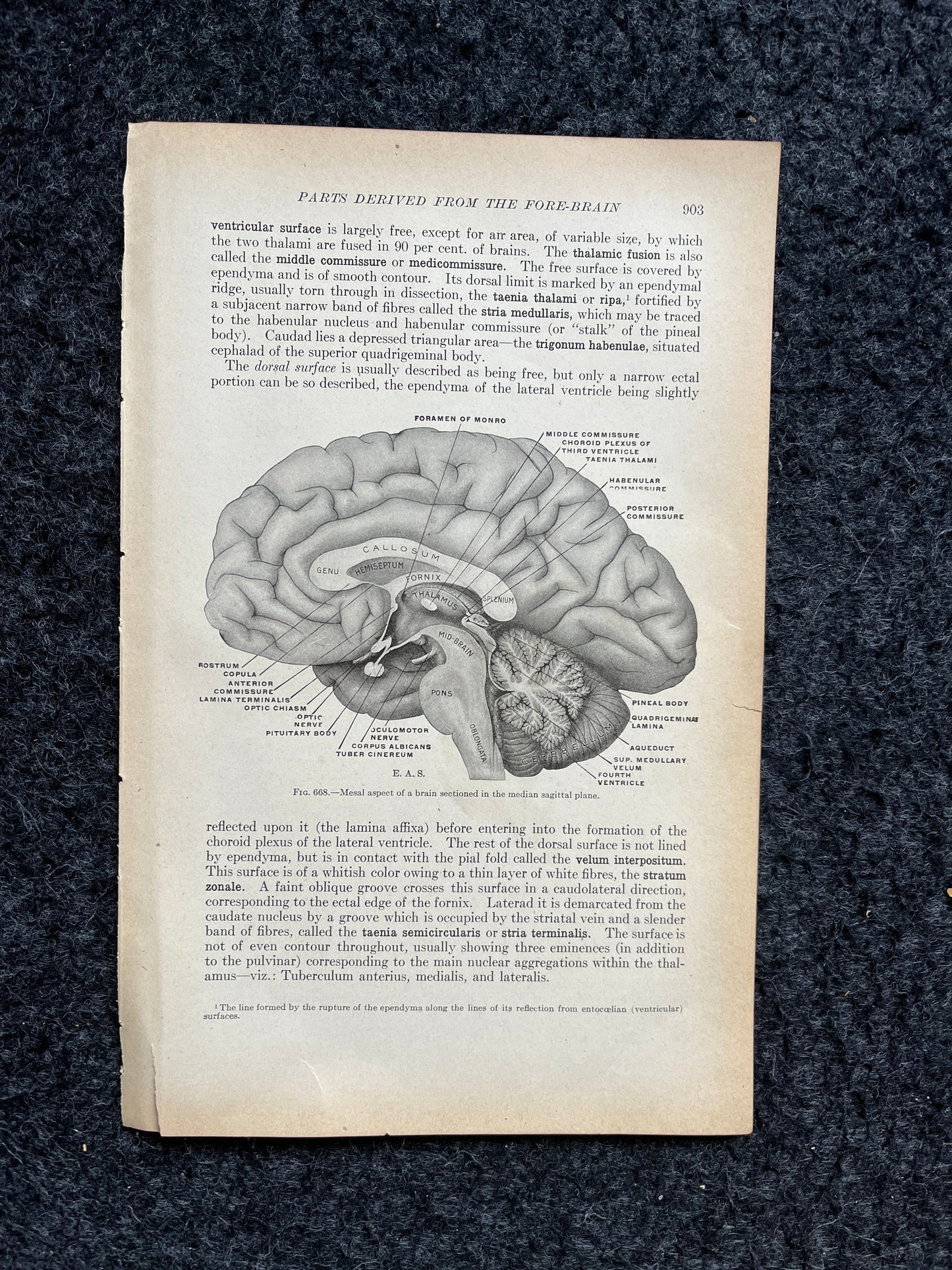 Original 1913 Anatomy Pages of Human Body, Anatomy Physiology Textbook Gifts, Teachers Aid Biology, Heart Brain Lung Art Wall Decoration