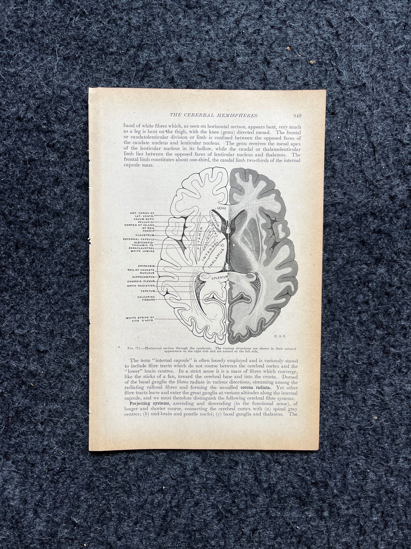 Original 1913 Anatomy Pages of Human Body, Anatomy Physiology Textbook Gifts, Teachers Aid Biology, Heart Brain Lung Art Wall Decoration