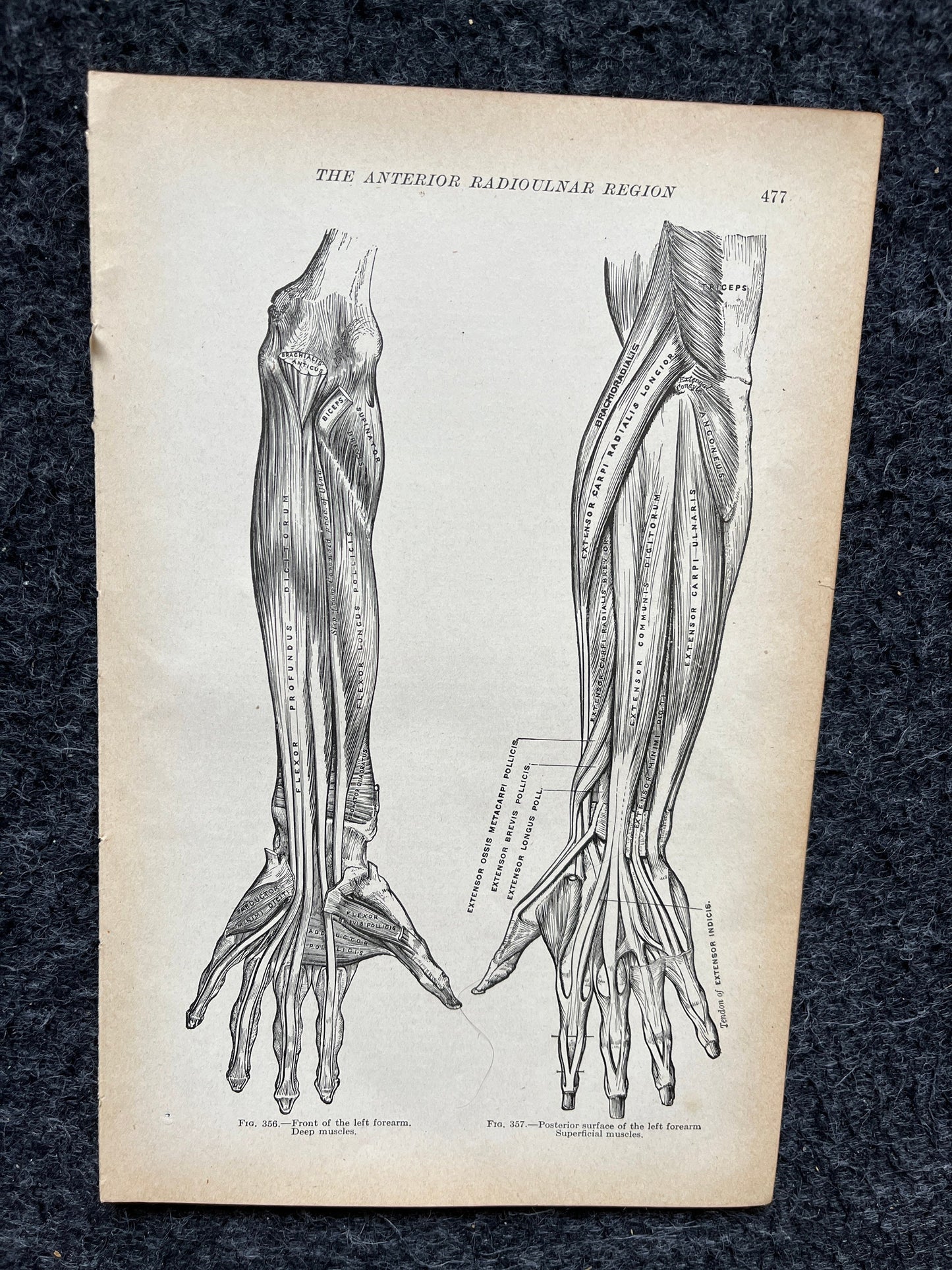 Original 1913 Anatomy Pages of Human Body, Anatomy Physiology Textbook Gifts, Teachers Aid Biology, Heart Brain Lung Art Wall Decoration