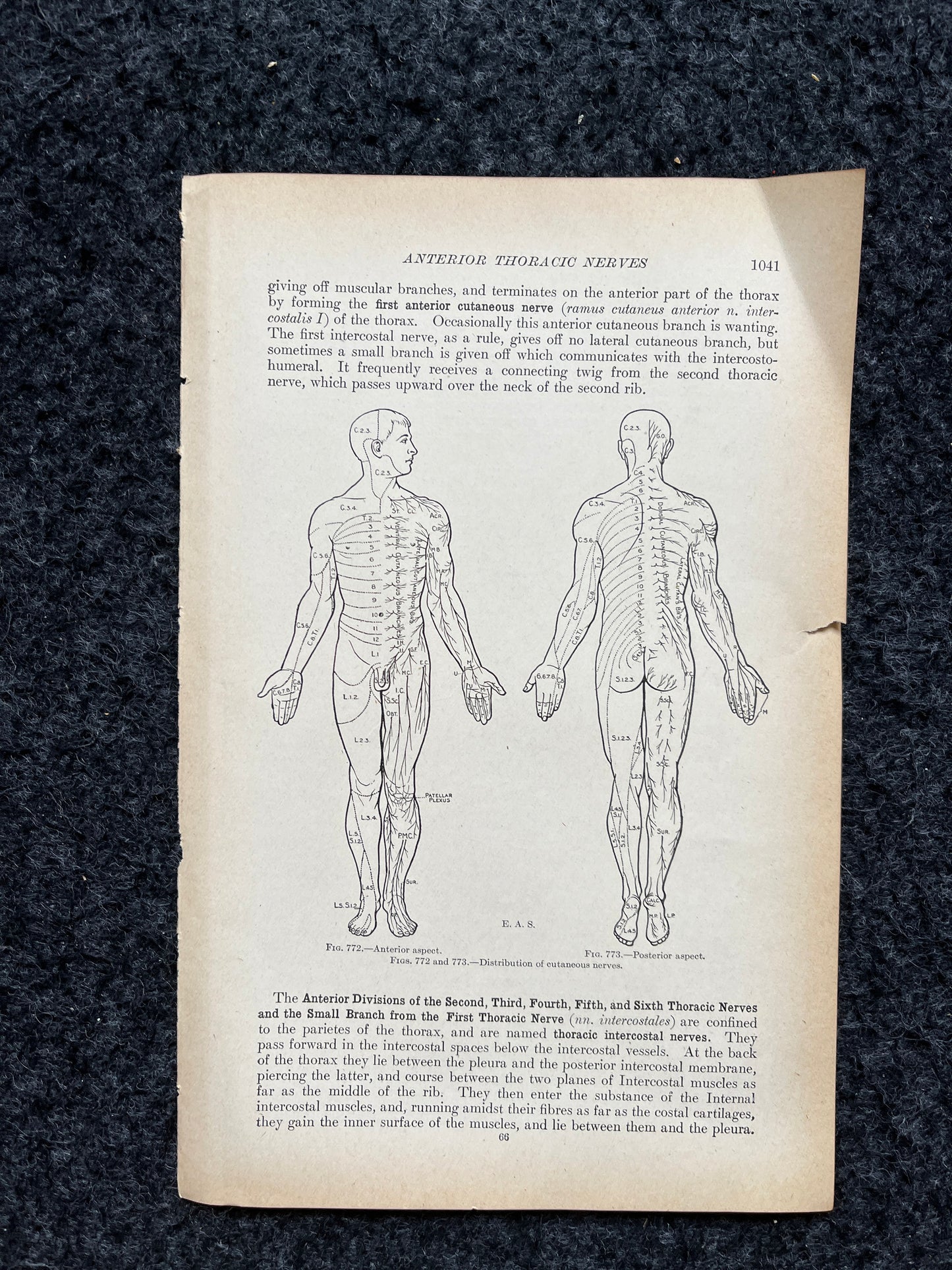 Original 1913 Anatomy Pages of Human Body, Anatomy Physiology Textbook Gifts, Teachers Aid Biology, Heart Brain Lung Art Wall Decoration