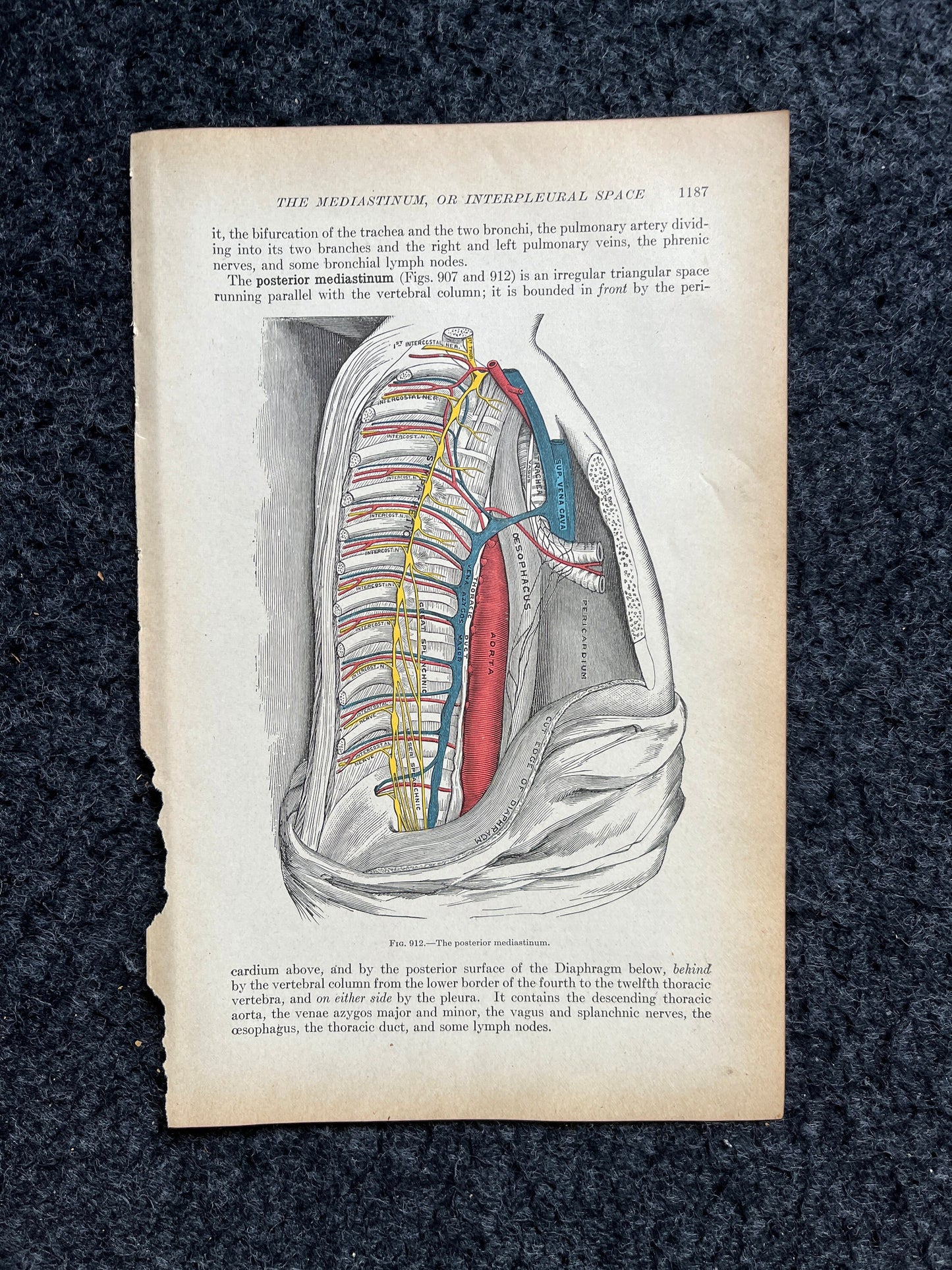 Original 1913 Anatomy Pages of Human Body, Anatomy Physiology Textbook Gifts, Teachers Aid Biology, Heart Brain Lung Art Wall Decoration