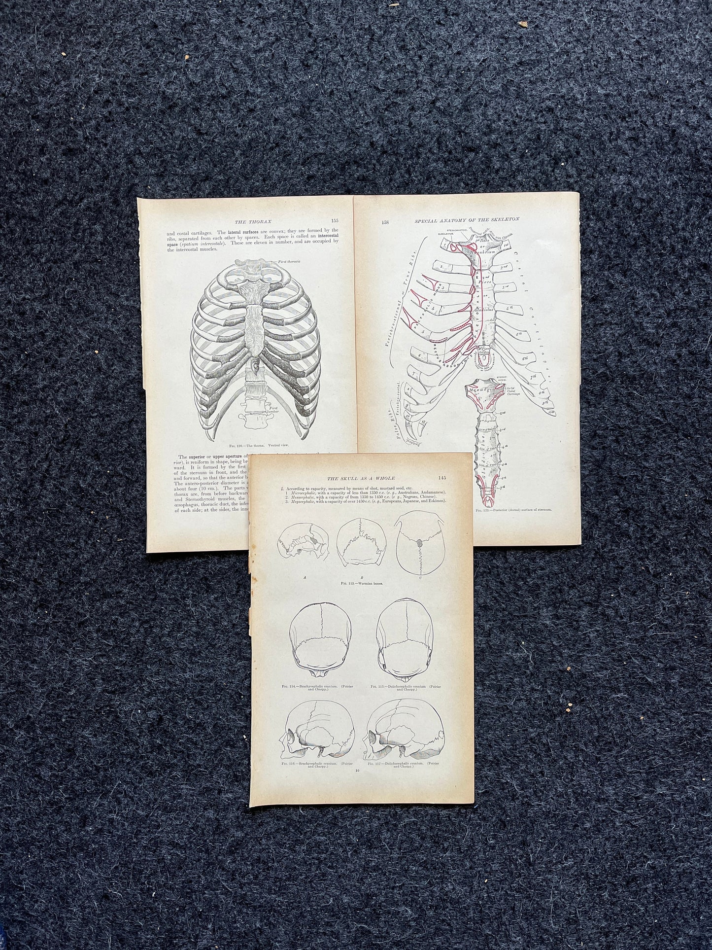 Original 1913 Anatomy Pages of Human Body, Anatomy Physiology Textbook Gifts, Teachers Aid Biology, Heart Brain Lung Art Wall Decoration