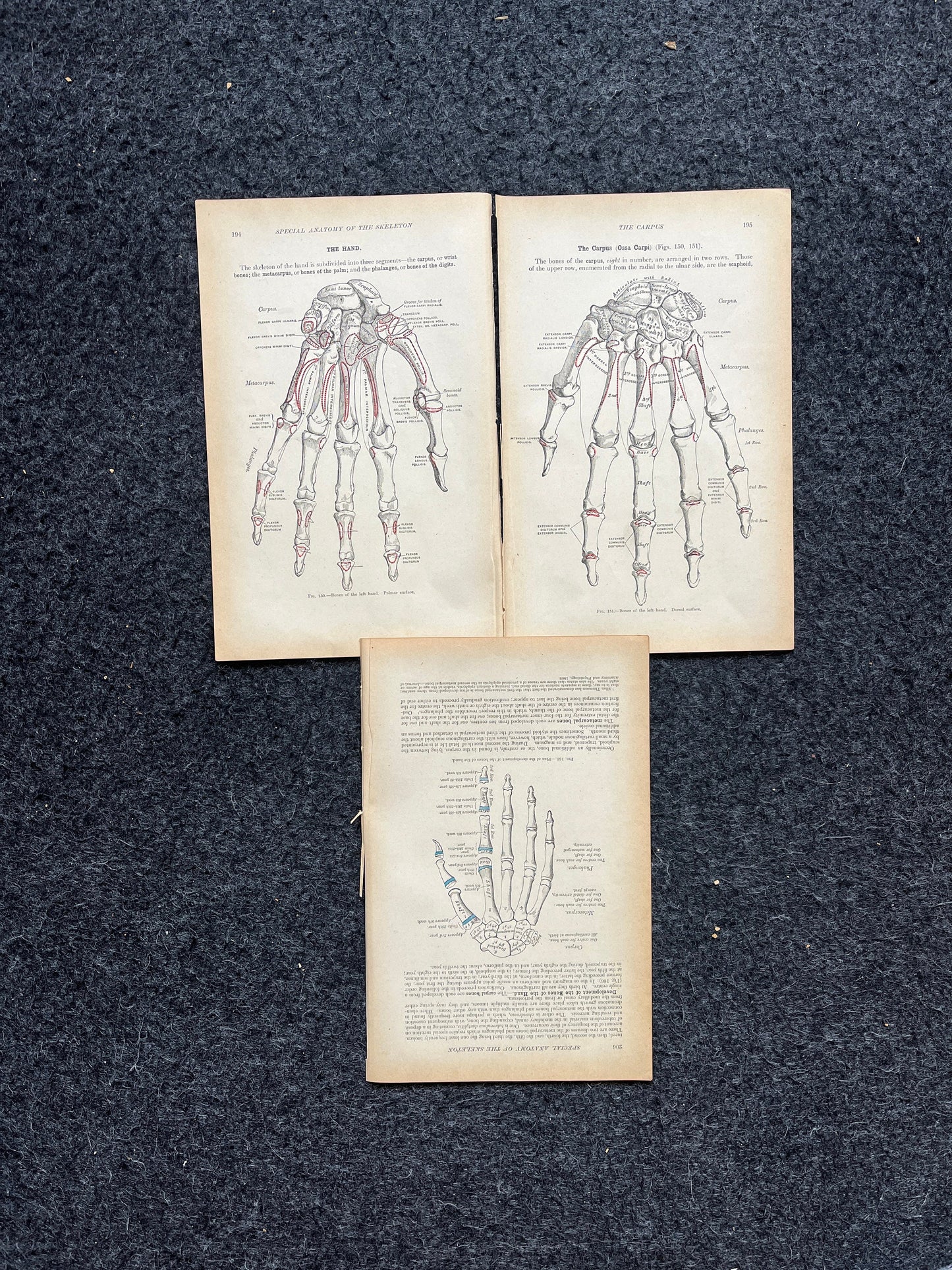 Original 1913 Anatomy Pages of Human Body, Anatomy Physiology Textbook Gifts, Teachers Aid Biology, Heart Brain Lung Art Wall Decoration