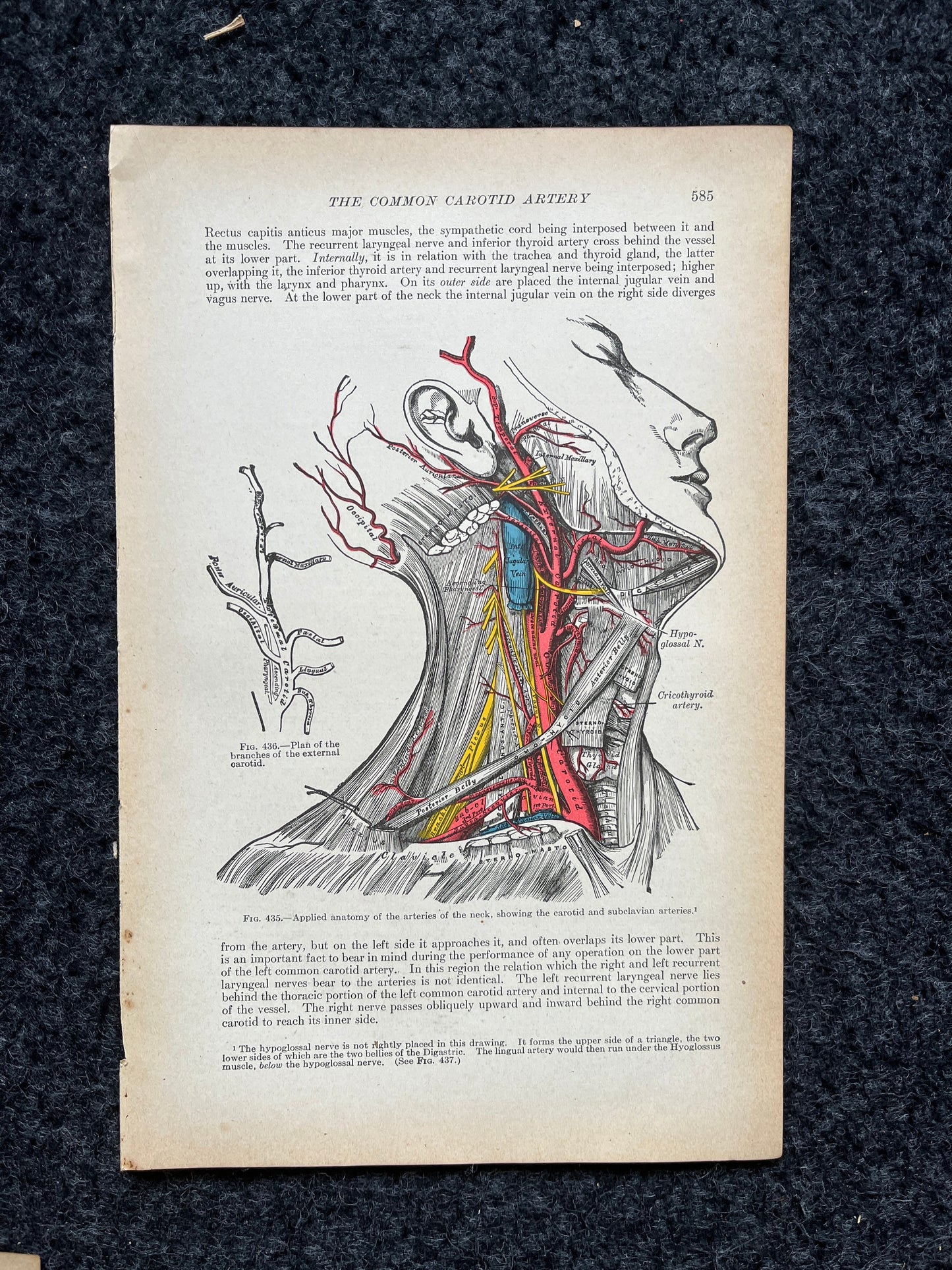 Original 1913 Anatomy Pages of Human Body, Anatomy Physiology Textbook Gifts, Teachers Aid Biology, Heart Brain Lung Art Wall Decoration