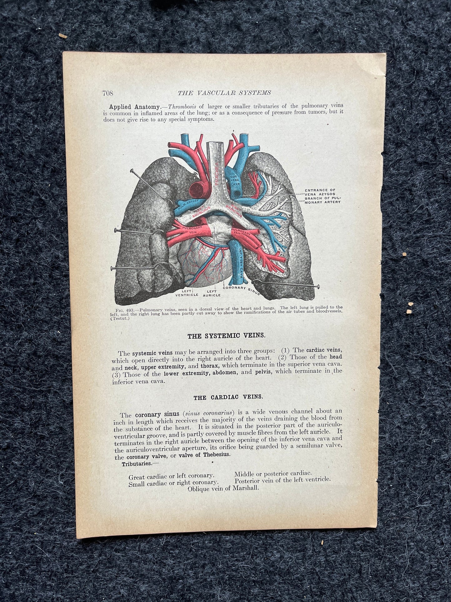 Original 1913 Anatomy Pages of Human Body, Anatomy Physiology Textbook Gifts, Teachers Aid Biology, Heart Brain Lung Art Wall Decoration