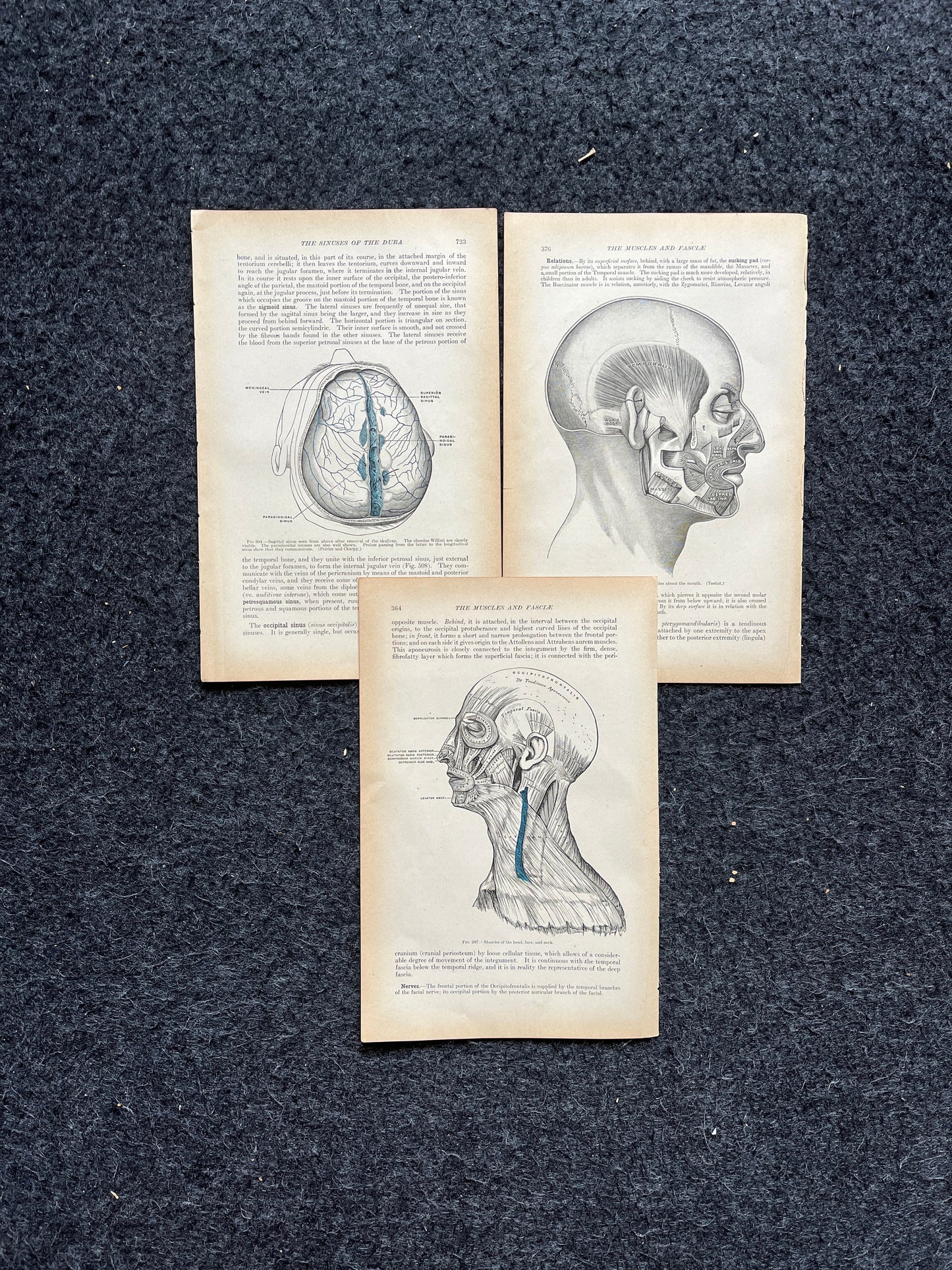Original 1913 Anatomy Pages of Human Body, Anatomy Physiology Textbook Gifts, Teachers Aid Biology, Heart Brain Lung Art Wall Decoration