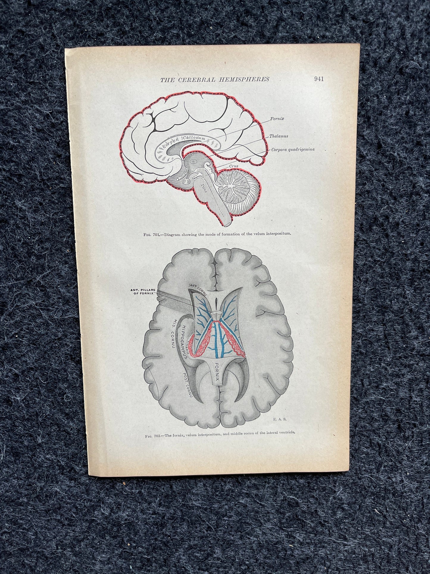 Original 1913 Anatomy Pages of Human Body, Anatomy Physiology Textbook Gifts, Teachers Aid Biology, Heart Brain Lung Art Wall Decoration