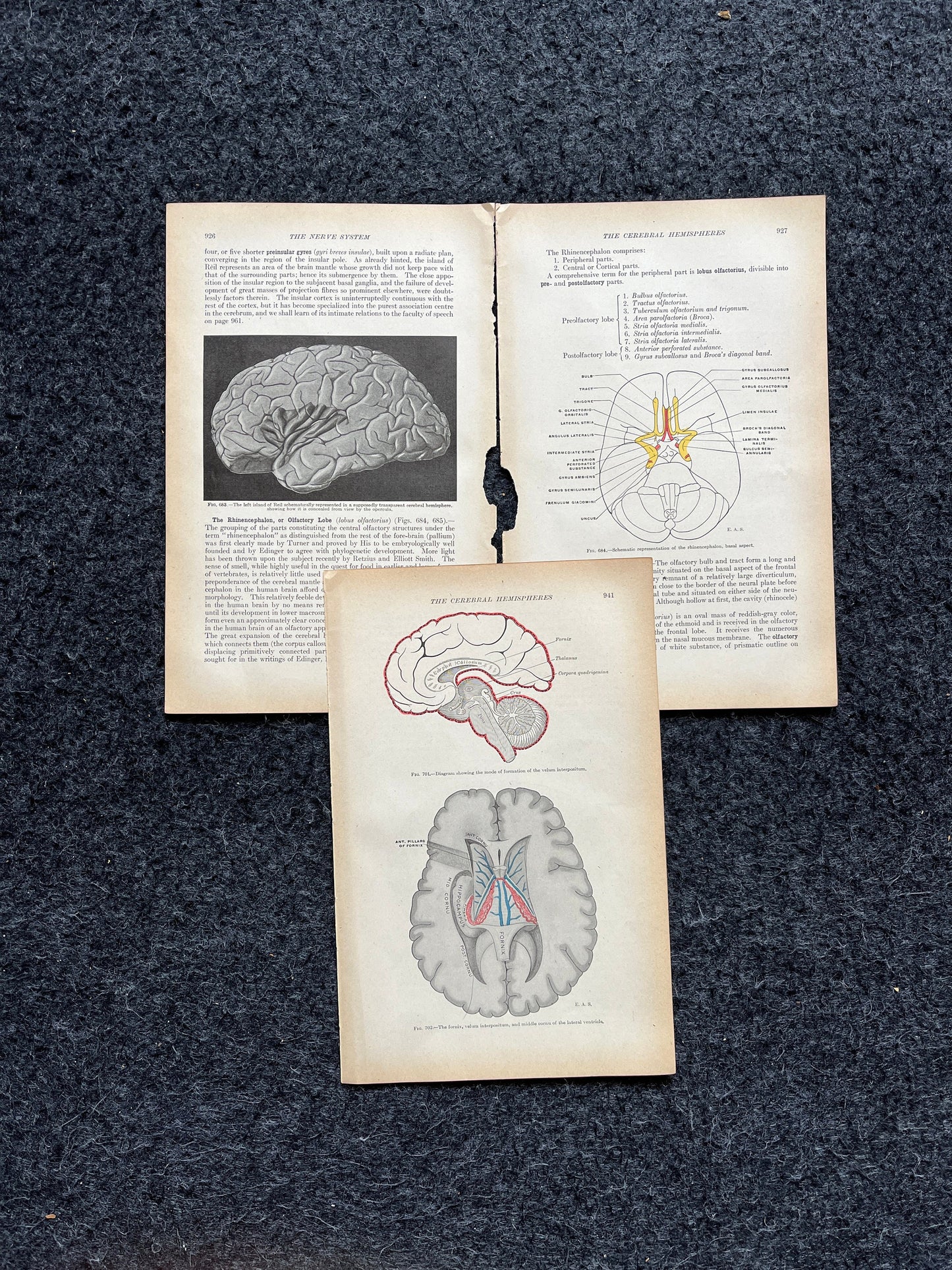 Original 1913 Anatomy Pages of Human Body, Anatomy Physiology Textbook Gifts, Teachers Aid Biology, Heart Brain Lung Art Wall Decoration