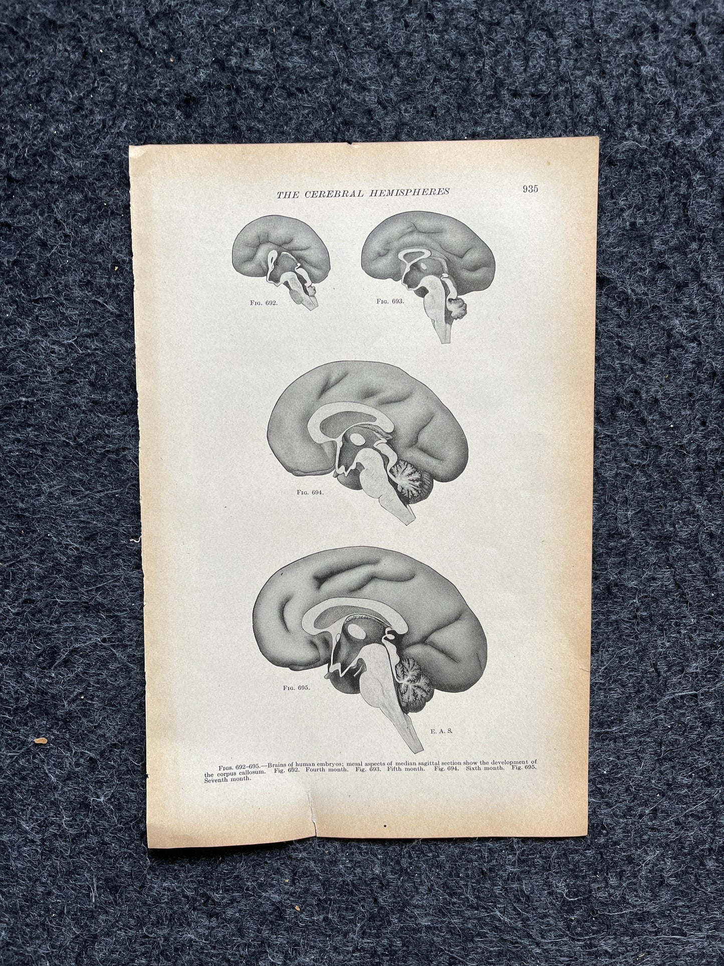 Original 1913 Anatomy Pages of Human Body, Anatomy Physiology Textbook Gifts, Teachers Aid Biology, Heart Brain Lung Art Wall Decoration