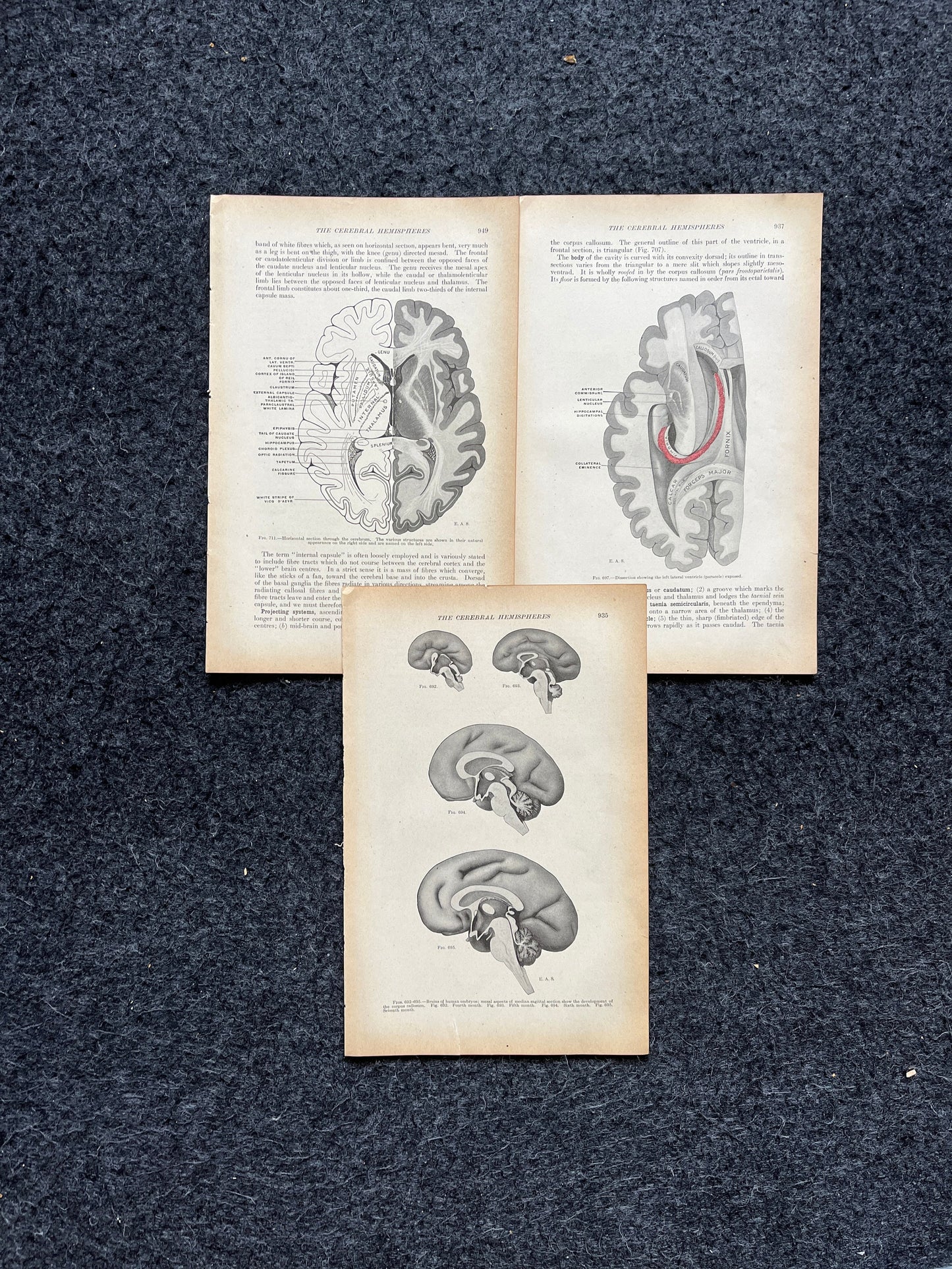 Original 1913 Anatomy Pages of Human Body, Anatomy Physiology Textbook Gifts, Teachers Aid Biology, Heart Brain Lung Art Wall Decoration