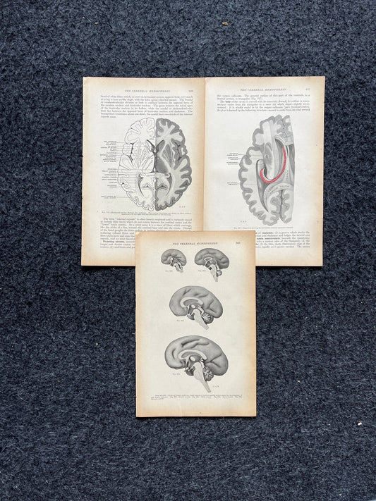Original 1913 Anatomy Pages of Human Body, Anatomy Physiology Textbook Gifts, Teachers Aid Biology, Heart Brain Lung Art Wall Decoration