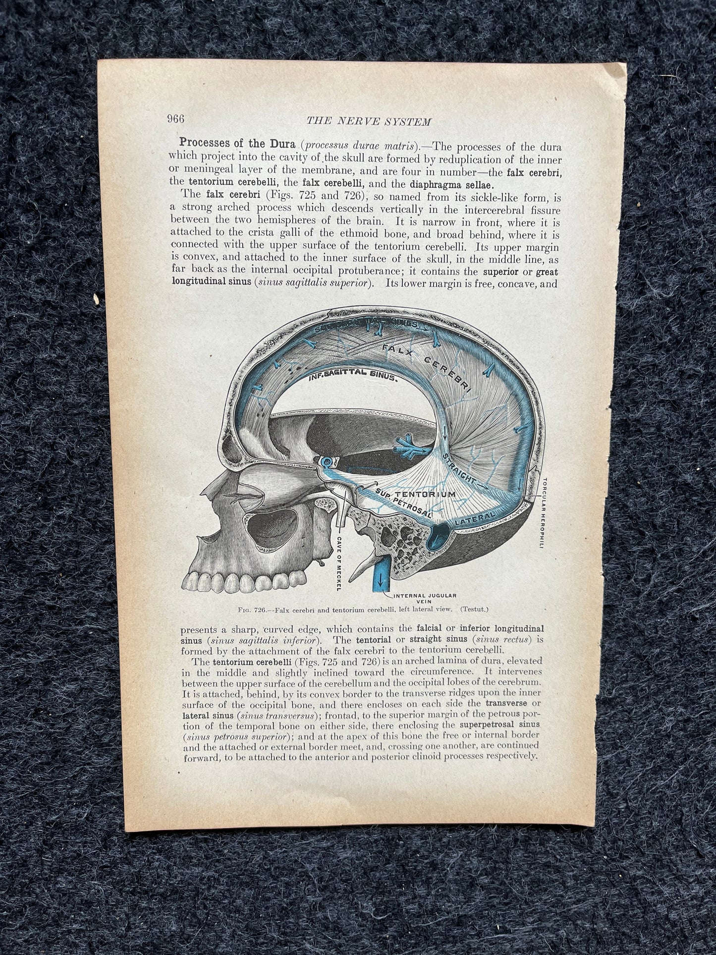 Original 1913 Anatomy Pages of Human Body, Anatomy Physiology Textbook Gifts, Teachers Aid Biology, Heart Brain Lung Art Wall Decoration